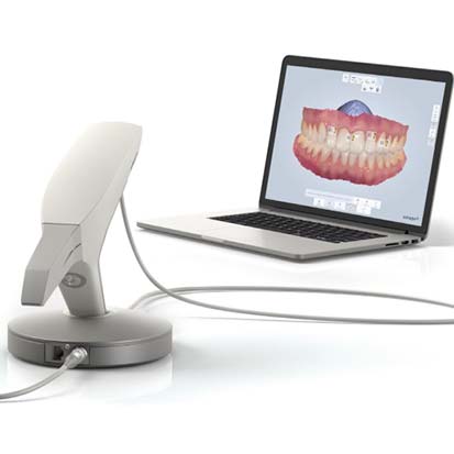 Trios Digital Dentistry | Concept Dentistry | SE Calgary Dentist