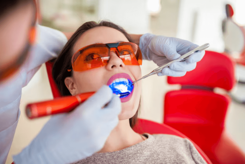 Top 5 Proven Benefits of Professional Teeth Whitening Treatments