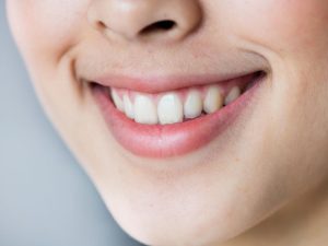 does teeth whitening hurt understanding sensitivity and side effects